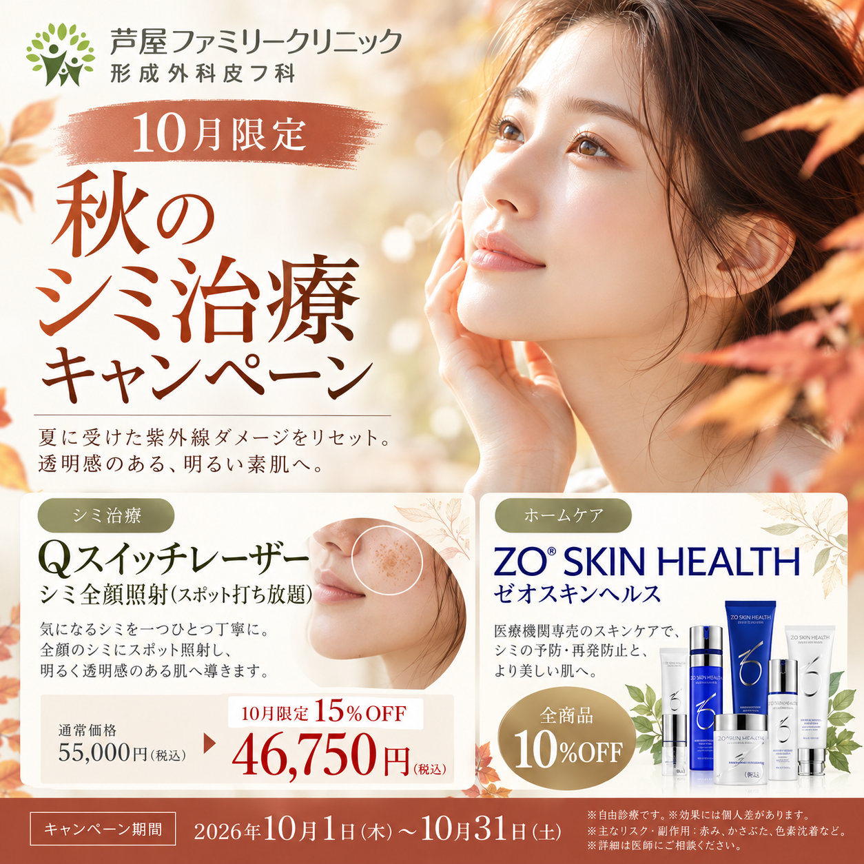 シミ治療キャンペーン